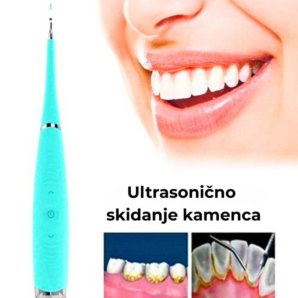 Ultrasonični Uređaj za Čišćenje Zuba i Uklanjanje Naslaga